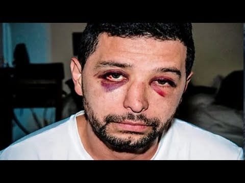 Anti-Gay Hate Crimes Plague Brooklyn | Man Beaten