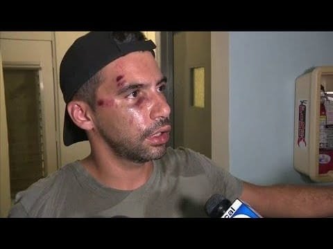 Gay couple believes Miami Beach attack was hate crime