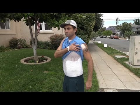 Gay man says he was set on fire in 'hate-filled' attack in San Diego