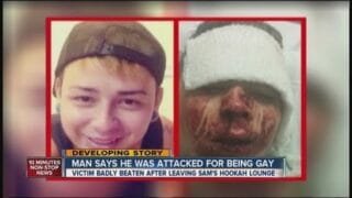 Hate-crime probe in beating of gay man