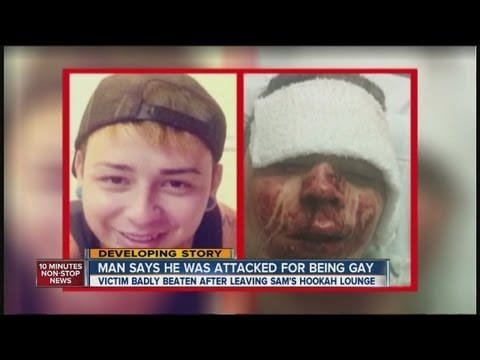 Hate-crime probe in beating of gay man